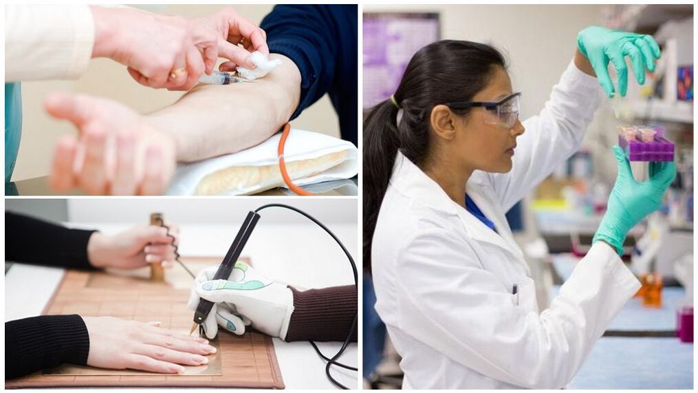 Diagnostične metode za odkrivanje parazitov v telesu