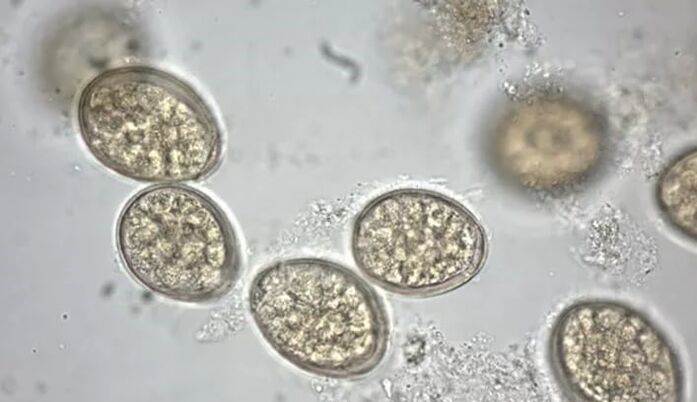 paraziti pod mikroskopom